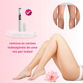 VariLife™ Removedor de varizes - Tenha pernas lisas novamente